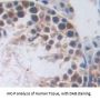 RAD51 Homolog (RAD51) Antibody
