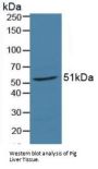 Retinoic Acid Receptor Alpha (RARa) Antibody