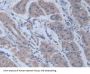 Retinoic Acid Receptor Alpha (RARa) Antibody