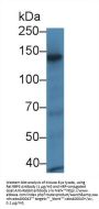 Retinol Binding Protein 3, Interstitial (RBP3) Antibody