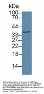 Ribonuclease H2 Subunit A (RNASEH2A) Antibody