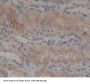 Protein Tyrosine Phosphatase Receptor Type K (PTPRK) Antibody