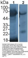Methyl CpG Binding Protein 2 (MECP2) Antibody