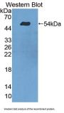 Tyrosyl DNA Phosphodiesterase 1 (TDP1) Antibody