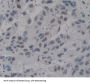 Tyrosyl DNA Phosphodiesterase 1 (TDP1) Antibody