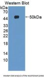 Src Kinase Associated Phosphoprotein 1 (SKAP1) Antibody