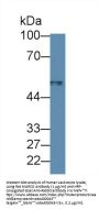 Macrophage Receptor MARCO (MARCO) Antibody