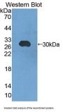 Chromogranin B (CHGB) Antibody