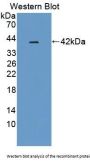 Pim-3 Oncogene (PIM3) Antibody