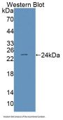 Squamous Cell Carcinoma Antigen (SCCA1/A2) Antibody