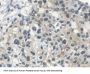 Squamous Cell Carcinoma Antigen (SCCA1/A2) Antibody