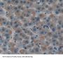 Squamous Cell Carcinoma Antigen (SCCA1/A2) Antibody