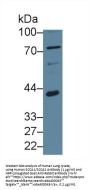 Squamous Cell Carcinoma Antigen (SCCA1/A2) Antibody