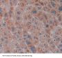 Squamous Cell Carcinoma Antigen (SCCA1/A2) Antibody
