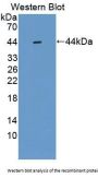 Spermine Synthase (SMS) Antibody