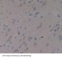 Spermine Synthase (SMS) Antibody