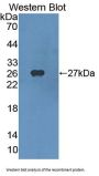 Sterol Regulatory Element Binding Transcription Factor 1 (SREBF1) Antibody
