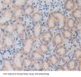 Sterol Regulatory Element Binding Transcription Factor 1 (SREBF1) Antibody