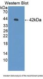 Synaptotagmin I (SYT1) Antibody