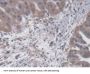Synaptotagmin I (SYT1) Antibody