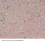 Synaptotagmin I (SYT1) Antibody