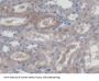 Threonine Aspartase 1 (TASP1) Antibody