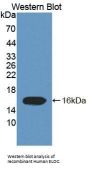 Elongin C (ELOC) Antibody