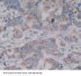 Interleukin 2 (IL2) Antibody