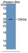 Topoisomerase II Binding Protein 1 (TOPBP1) Antibody