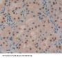 Topoisomerase II Binding Protein 1 (TOPBP1) Antibody