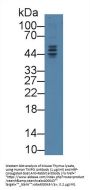 Thymopoietin (TMPO) Antibody