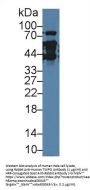 Thymopoietin (TMPO) Antibody