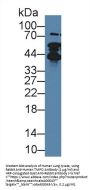 Thymopoietin (TMPO) Antibody