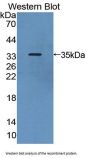 Thymopoietin (TMPO) Antibody