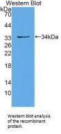Protocadherin 15 (PCDH15) Antibody