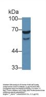 Wiskott Aldrich Syndrome Protein (WASP) Antibody