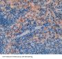 Wiskott Aldrich Syndrome Protein (WASP) Antibody
