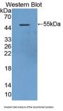 Death Associated Protein Kinase 3 (DAPK3) Antibody