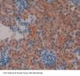 Death Associated Protein Kinase 3 (DAPK3) Antibody