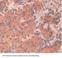 Apolipoprotein A5 (APOA5) Antibody