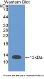 Beta-2-Microglobulin (B2M) Antibody