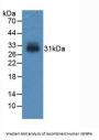 Insulin Like Growth Factor Binding Protein 4 (IGFBP4) Antibody