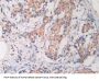 Cathelicidin Antimicrobial Peptide (CAMP) Antibody