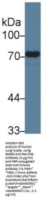 Endoglin / CD105 (ENG) Antibody