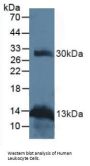 Tumor Necrosis Factor Ligand Superfamily Member 11 (TNFSF11) Antibody