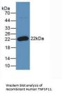 Tumor Necrosis Factor Ligand Superfamily Member 11 (TNFSF11) Antibody