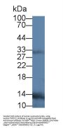 Tumor Necrosis Factor Ligand Superfamily Member 11 (TNFSF11) Antibody