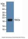 Tumor Necrosis Factor Ligand Superfamily Member 11 (TNFSF11) Antibody