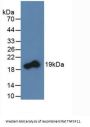 Tumor Necrosis Factor Ligand Superfamily Member 11 (TNFSF11) Antibody