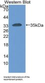 Carcinoembryonic Antigen Related Cell Adhesion Molecule 1 (CEACAM1) Antibody